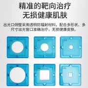 光专嘉308nm准分子光疗仪白癜风银屑病治疗仪紫外线灯uvb治疗仪器